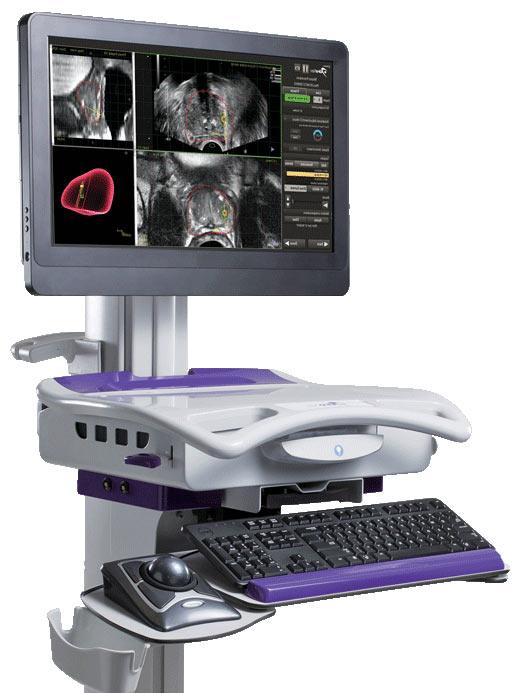UroNav, MRI and ultrasound